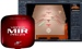 MIRPro24 - Gallery Photo 1